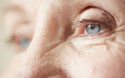 Age Related Macular Degeneration (AMD)