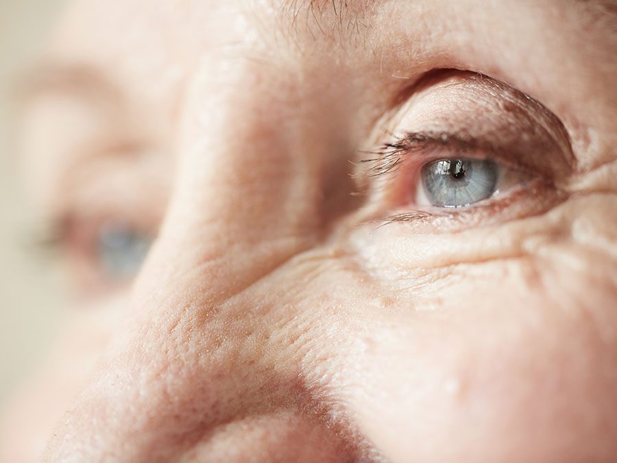 Age Related Macular Degeneration (AMD)